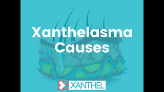 XANTHELASMA CAUSES What are the cause of Xanthelasma and Xanthomas  Brought To You By XANTHEL ® [upl. by Elrahc]