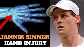 Jannik Sinner  Injured Hand at US Open [upl. by Resaec]