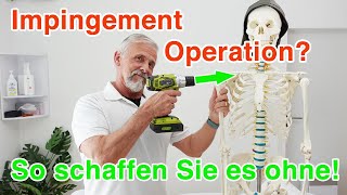 Impingement OP der Schulter ➡️ So schaffen Sie es ohne [upl. by Atcele]