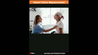 Heart Valve Replacement Options for Heart DiseaseShorts [upl. by Rollins]