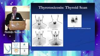 Monday Thyroid and Parathyroid Scintigraphy Rodolfo Nuñez [upl. by Oisacin]