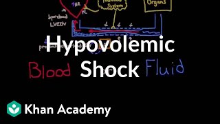 Hypovolemic shock  Circulatory System and Disease  NCLEXRN  Khan Academy [upl. by Iiette986]