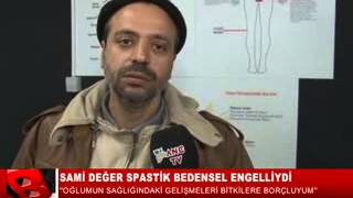 SPASTİK ENGELLİ HASTAMIZ ANLATIYOR [upl. by Ezekiel]