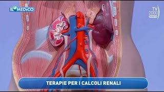 Il Mio Medico Tv2000  Nuove tecniche per rimuovere i calcoli renali [upl. by Ethelda]