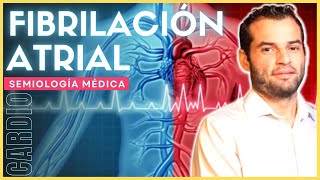 Semiología cardiovascular  Fibrilación atrial [upl. by Catha885]