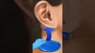 Asmr ear piercing infection treatment shorts animation skincare [upl. by Edwina306]