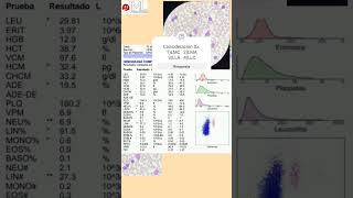 Interpretando el hemograma hematologia medicina [upl. by Moreland]