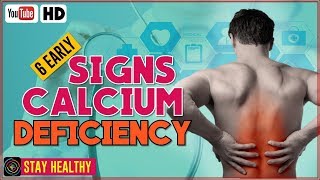 Signs and Dangers of Calcium Deficiency  Calcium Deficiency Symptoms [upl. by Nonarb]