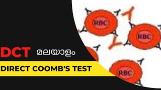 DCTDirect Coombs test മലയാളം [upl. by Shreeves996]