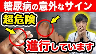 【放置厳禁】知らないと後悔する糖尿病が『進行している』SOSサイン【注意な合併症】初期症状を現役医師が簡単解説します。【アニメーション】 [upl. by Ahs]