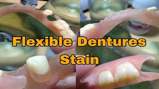 Flexible Dentures Stain Removal [upl. by Karlin]