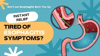 Ease Your Esophagus 5 Effective Natural Remedies for Esophagitis [upl. by Bautram]