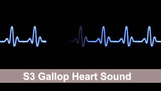 S3 Gallop Heart Sound Collection For Auscultation Skills [upl. by Yendor723]