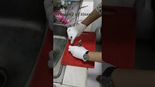 Biopsy  grossing of tissue  thyroid biopsy  thyroid tissue youtubeshorts biopsy tissue lab [upl. by Artenra594]