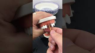 new type of dental filling toothfactory [upl. by Dahsar277]