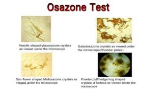 Osazone test for the detection of reducing sugers Knowledge Academy [upl. by Blessington]