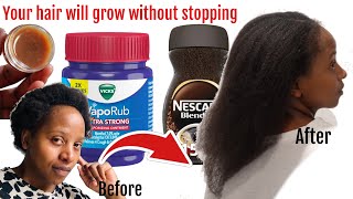 Mix Coffee amp Vicks Vapour Rub Your hair will grow too fast without stopping [upl. by Ives550]