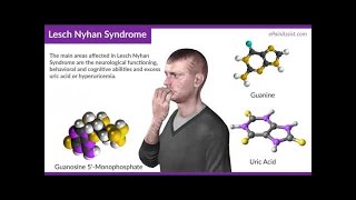 INBORN ERRORS OF NUCLEIC ACID METABOLISM  LESCH–NYHAN SYNDROME [upl. by Aknaib]