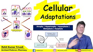 Cellular Adaptation Pathology  Atrophy  Hypertrophy  Hyperplasia  Dysplasia  Metaplasia [upl. by Suivat]