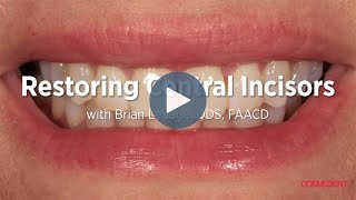 Restoring Central Incisors with Composite with Brian LeSage DDS FAACD [upl. by Anirec366]