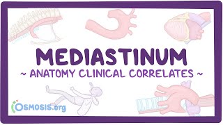 Anatomy clinical correlates Mediastinum [upl. by Aisel]