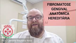 Cirurgia de remoção da Fibromatose Gengival Anatômica Idiopática Biópsia com bisturi elétrico [upl. by Primrosa]