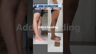 Genu recurvatum correction in Mumbai genurecurvatum bowlegs [upl. by Magda]