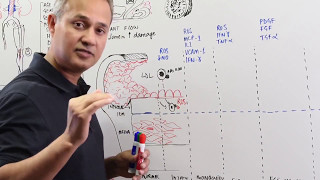 Atherosclerosis Pathology and Cellular Events [upl. by Idell]