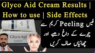 GLYCO Aid Cream Review In Urdu  Glycolic Acid 10 cream Benefits in Urdu  AHA 10 Cream Uses [upl. by Beitz166]