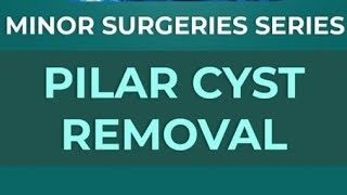 Pilar Cyst Removal by RPM Health rpmhealthclinic [upl. by Guillaume]