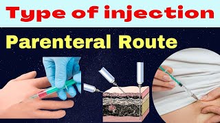 Parenteral route  drug administration  type of injection  pharmacology  route of administration [upl. by Nawk532]