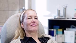 Ultherapy® München  UltraschallLifting bei Dr Tatjana Pavicic [upl. by Putnem]