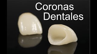 CORONAS DENTALES SOBRE IMPLANTES  PRODENT  MEDICINA EXTRAORDINARIA [upl. by Darach835]