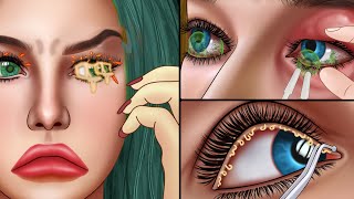 ASMR Clean eyelid inflatmmation Blepharitis animation  Dirty eye treatment [upl. by Draude]