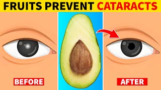 6 Fruits That Prevent Cataracts [upl. by Gabie]