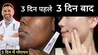 Skin Lite Cream Review 2024 in Hindi  Side Effects Uses and Result  गोरेपन की क्रीम Best Cream [upl. by Kasper]