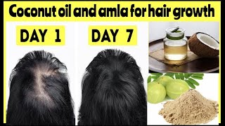 coconut oil and amla powder for hair growth amla powder for hair growthmixing amla and coconut oil [upl. by Enileqcaj]