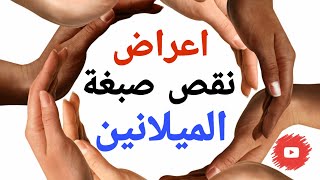 مرض نقص صبغة الميلانين و الفرق بين البهاق و البرص shorts [upl. by Melgar651]