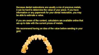 How To Sell Dental Gold [upl. by Ulrica]