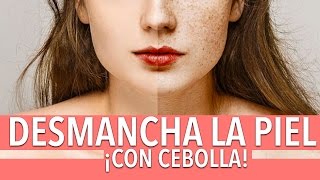 Cómo desmanchar la cara con cebolla  Yasmany [upl. by Mirabelle]