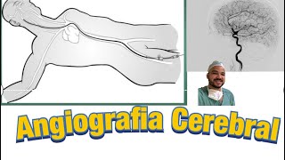 Angiografia Cerebral o que é [upl. by Akcira]