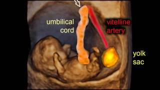 9 weeks of pregnancy gestational sac and embryo  3D scan [upl. by Stacey]