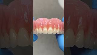 Great Gingiva Characterization lsk121shorts dentistry teeth [upl. by Sirromal762]