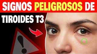 Descubre los 8 Peores Síntomas del Hipotiroidismo y Cómo Afectan tus Hormonas Tiroideas [upl. by Eerdna]