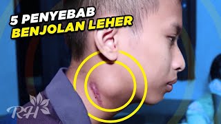 Penyebab Benjolan di Leher  5 Hal yang Perlu Kamu Tahu Sebelum Terlambat [upl. by Thinia]