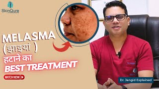 Best Treatment for Melasma  Laser Treatment for Melasma in Delhi  SkinQure  Dr Jangid [upl. by Nary]