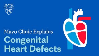 Mayo Clinic Explains Congenital Heart Defects [upl. by Yona]