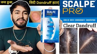 Scalpe Pro Anti Dandruff Shampoo Review  Daily Anti Dandruff Shampoo [upl. by Lleira]