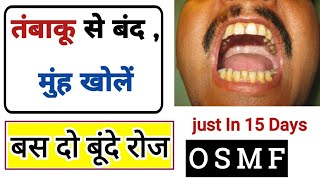 15 दिन में पूरा मुह खोले  oral sabmucous fibrosis Treatment  OSMF  SMF gel use  Dr tarun [upl. by Halda76]