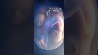 Twins Fighting in Mothers Womb shorts trendingshorts trendingreels viralvideo baby [upl. by Eiffe422]